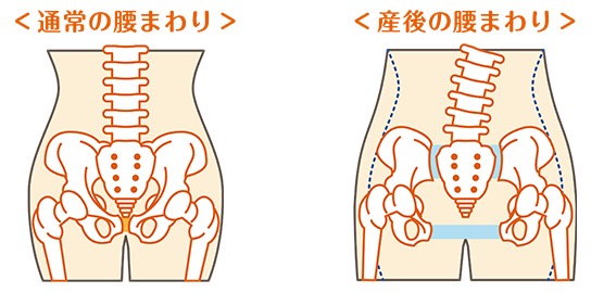 出産前と産後の骨盤を比較した画像